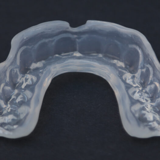 Protecting Your Child’s Smile: The Importance of Night Guards for Kids
