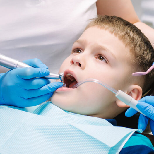 Sedation Options for Kids During Root Canal Therapy: Ensuring Comfort